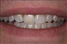 Herzliya Dental Clinic