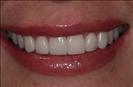 Herzliya Dental Clinic