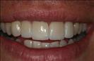 Herzliya Dental Clinic