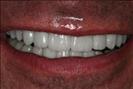 Herzliya Dental Clinic