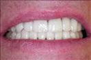 Herzliya Dental Clinic