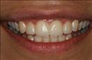 Herzliya Dental Clinic