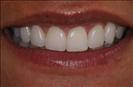 Herzliya Dental Clinic