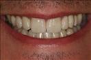 Herzliya Dental Clinic