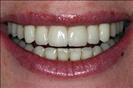 Herzliya Dental Clinic