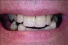 Herzliya Dental Clinic