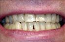Herzliya Dental Clinic