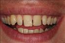 Herzliya Dental Clinic