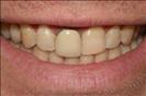 Herzliya Dental Clinic