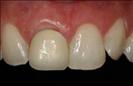 Herzliya Dental Clinic