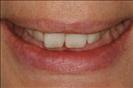 Herzliya Dental Clinic