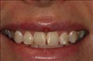 Herzliya Dental Clinic