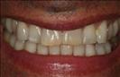 Herzliya Dental Clinic