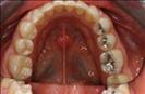 Herzliya Dental Clinic