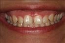 Herzliya Dental Clinic