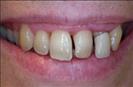 Herzliya Dental Clinic