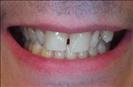 Herzliya Dental Clinic