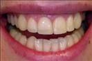Herzliya Dental Clinic