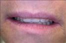 Herzliya Dental Clinic