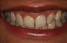 Herzliya Dental Clinic