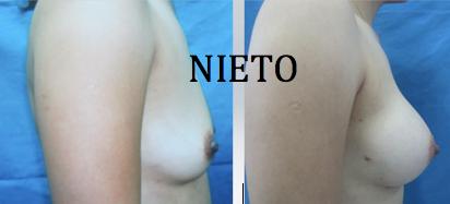 Nieto-Tejeda Plastic Surgery