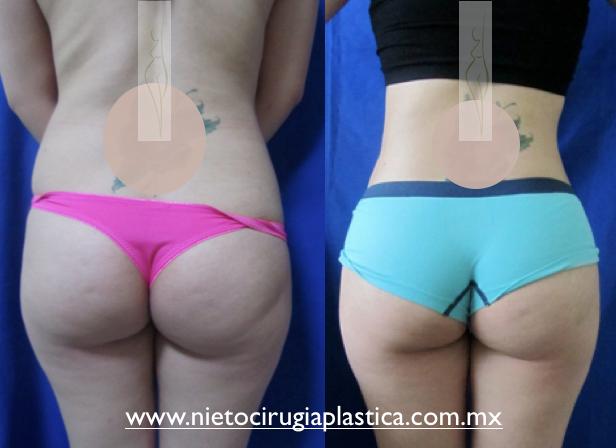 Nieto-Tejeda Plastic Surgery