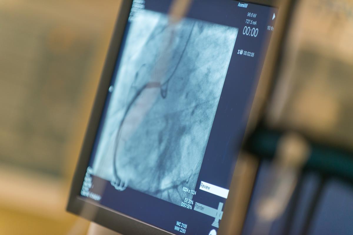 American Heart of Poland