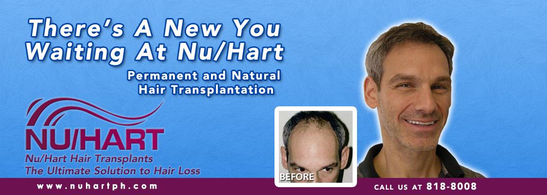 Nuhart Hair Restoration Philippines