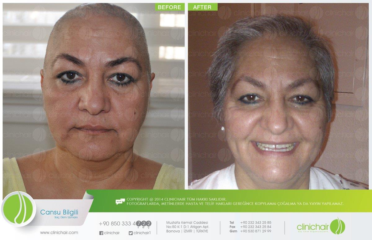 Photo gallery of Clinichair Hair Transplant Center medical centers