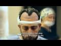 Hair Transplant at Acibadem