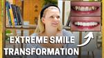 Getting the Dream Smile | Patient Testimonial