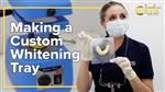How Personalized Whitening Trays Are Made