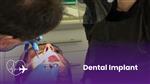 Dental Implant Process