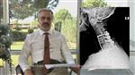 Spinal Diseases and Treatments – M.D. Prof. Serdar Kahraman
