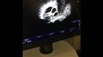 Egg Retrieval Procedure at Kyrenia IVF Center