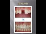 Our dental treatments: Before and After