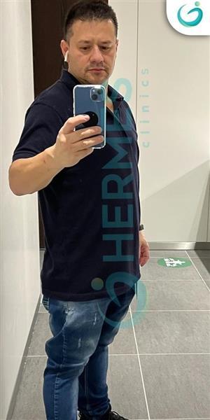 Gastric Sleeve Surgery