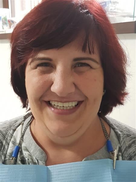 All on 6 implants – upper jaw